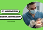 Full Mouth Rehabilitation: Dental Restoration and Reconstruction