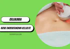 Cellulogia: Cellulite Treatment Guide understanding Cellulite