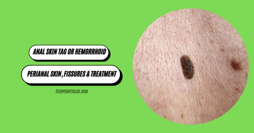 Anal Skin Tag or Hemorrhoid? Perianal Skin, Fissures & Treatment